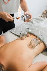 girl having cupping treatment at ripley massage ipswich